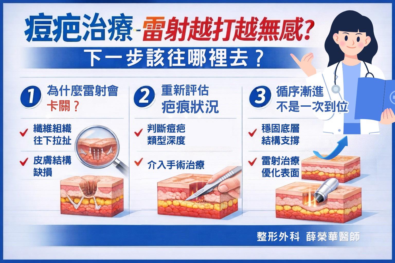 痘疤治療–雷射越打越無感？下一步該往哪裡去?